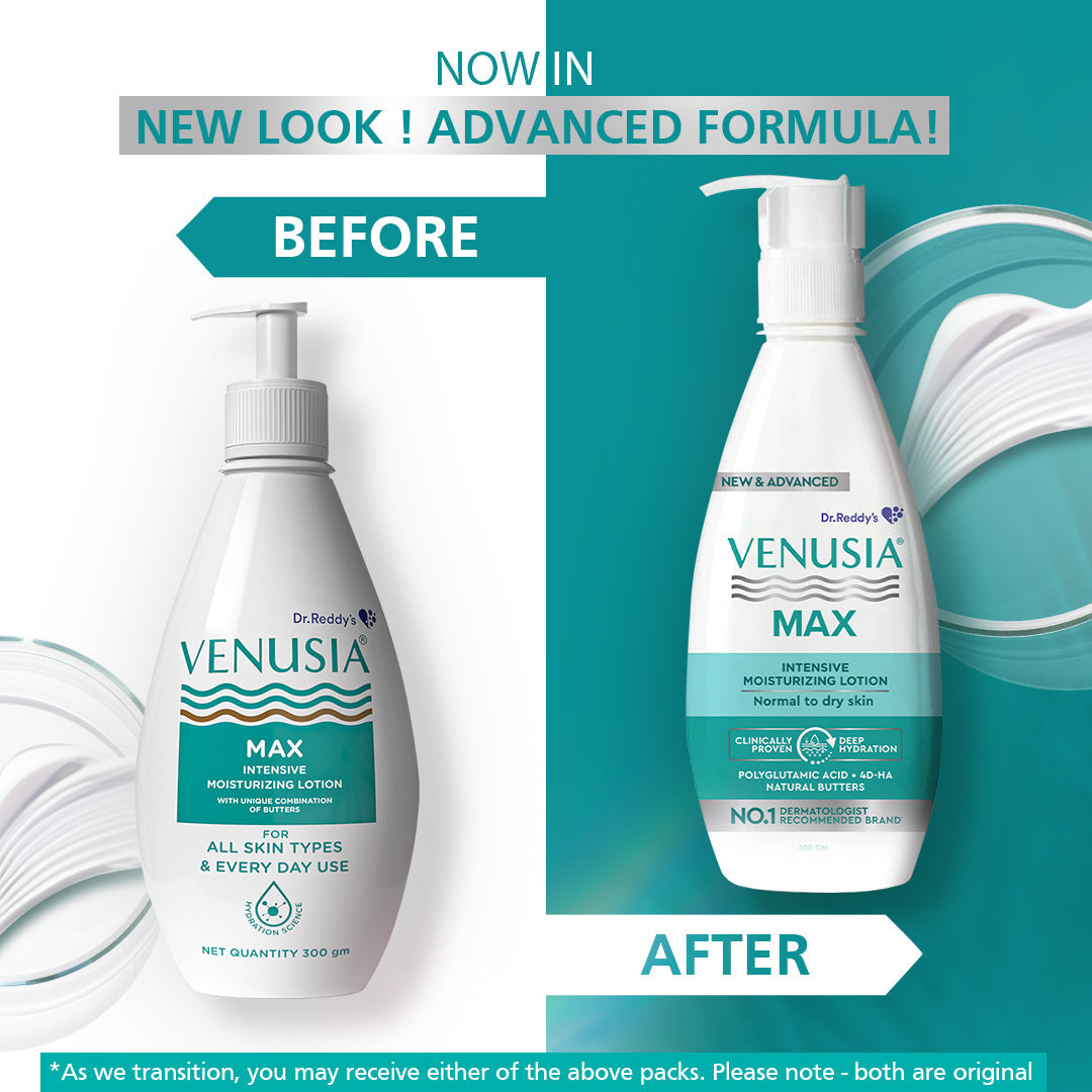 Venusia Max Intensive Moisturising Lotion | Long-Lasting Hydration | 300 g
